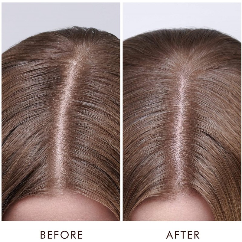 Moroccanoil Dry Scalp Treatment Kuru Saç Derisi Serumu 45ML